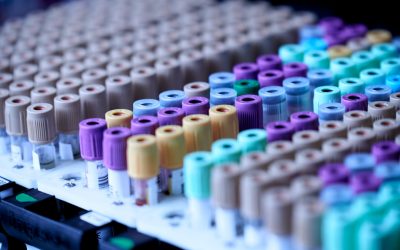 Bluttest verrät Zellalter: Dein Risiko für Alzheimer und ALS Jahre im Voraus erkennen